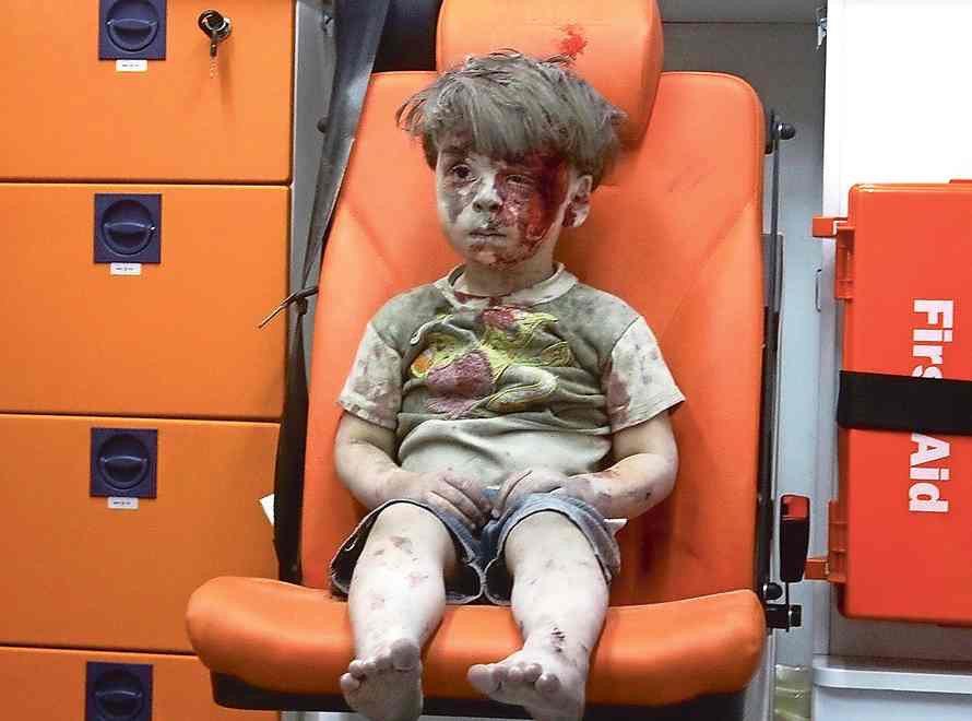 Tragedia i cierpienie dzieci w wojnie domowej w Syrii Tragedia i cierpienie dzieci w wojnie domowej w Syrii