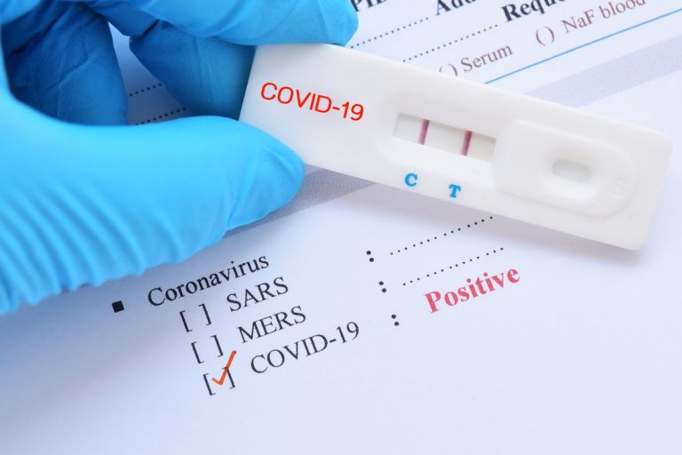 Ekspert: Covid-19 stanie się banalnym wirusem sezonowym