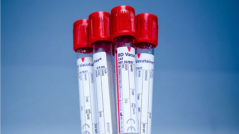 Chiny rozpoczynają wstępne testy szczepionki na koronawirusa